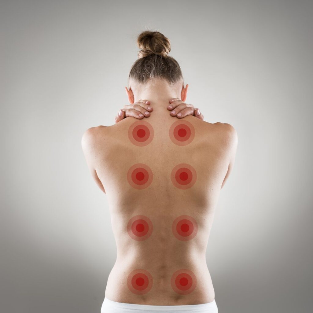 le dos d'une femme est marqué par des points douloureux